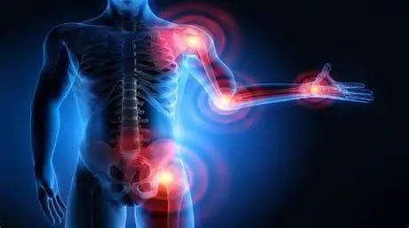 Rheumatology & Musculoskeletal Disorders