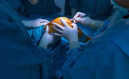 Arthroplasty